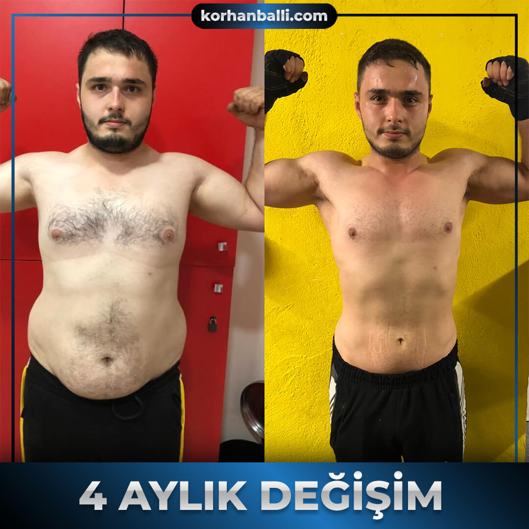 Korhan Ballı Değişimler Before & After